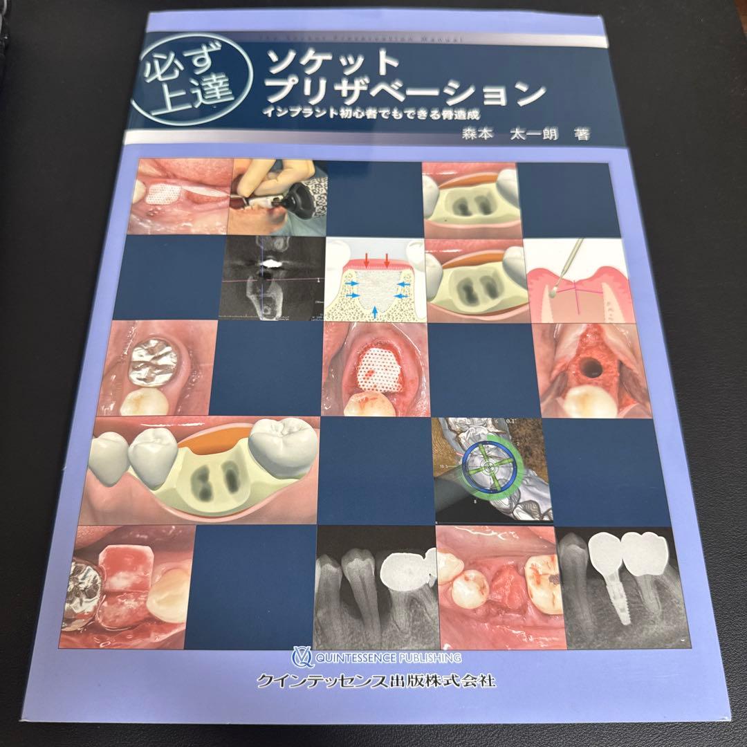 必ず上達 ソケットプリザベーション